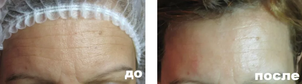до после описание.jpg до после описание.jpg