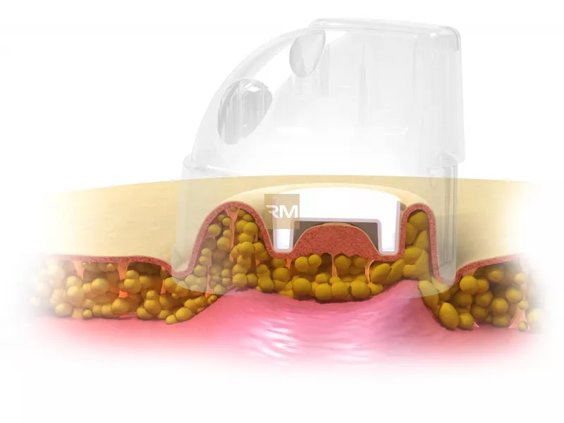 STARVAC DXTWIN SMART
